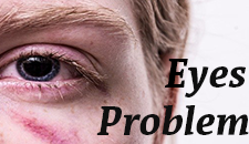 Eyes Problem